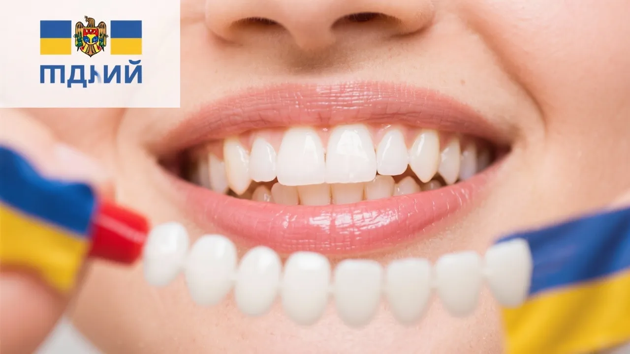 Discovering Veneers in Romania