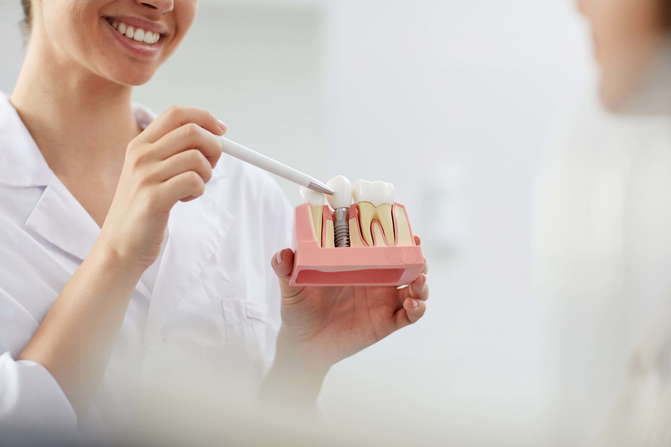 A Comprehensive Guide to Affordable Dental Implants